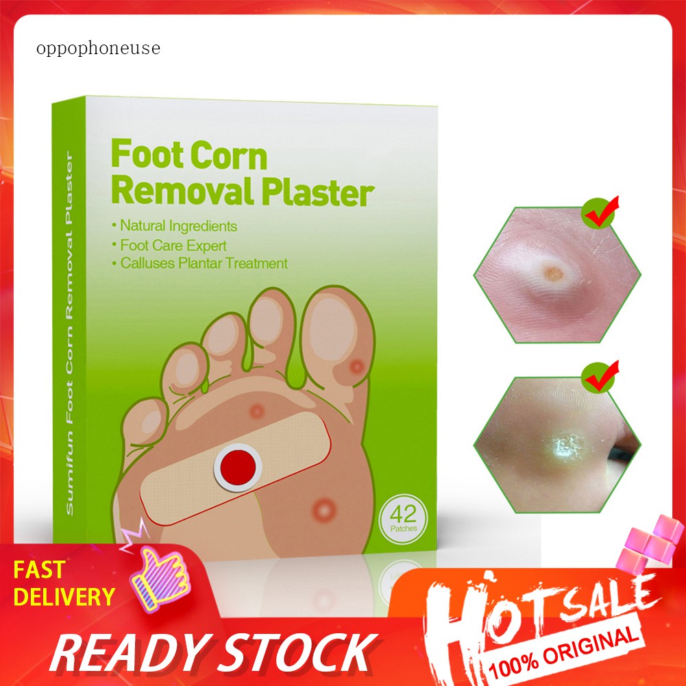 Foot corn removal plaster online