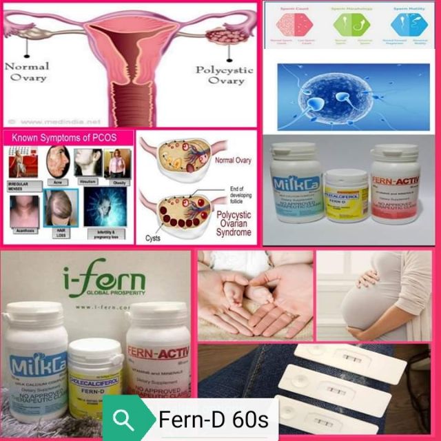 I-fern Products. 001 - What is Ovarian Cyst? An ovarian cyst is a