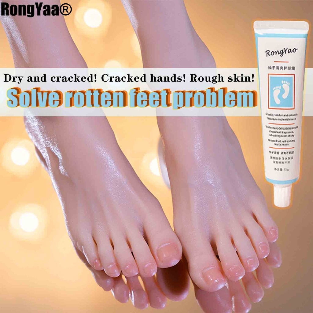 Leg crack cream on sale name