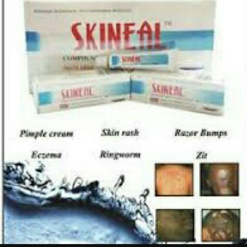 Skineal cream deals