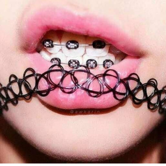 BRACES, Online Shop Shopee Philippines