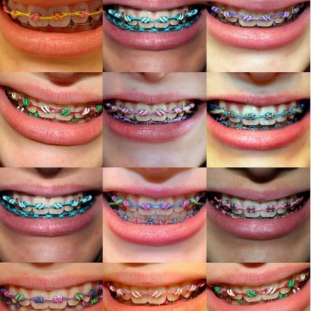 acp orthodontics materials, Online Shop Shopee Philippines