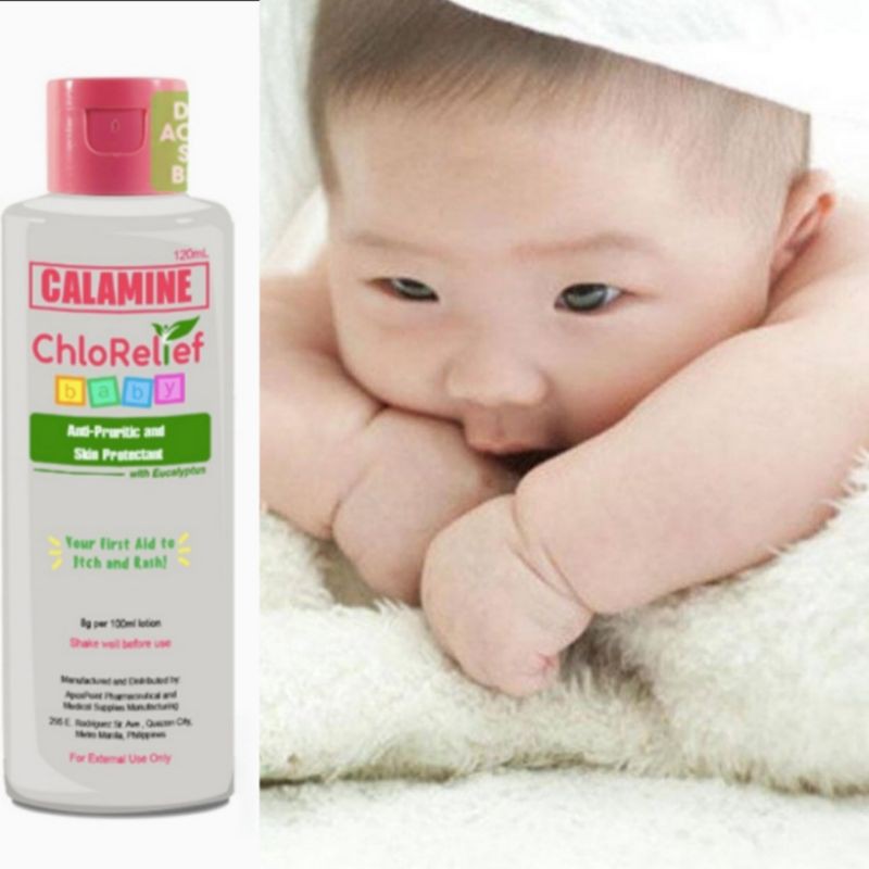 Anti itch cream for hot sale baby