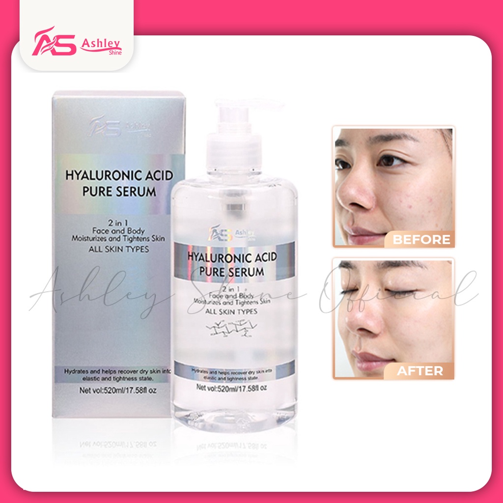 Ashley Hyaluronic Acid Pure Serum - ボディローション